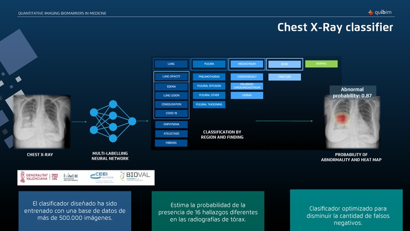 Presentaci�n �ngel Alberich - Quibim